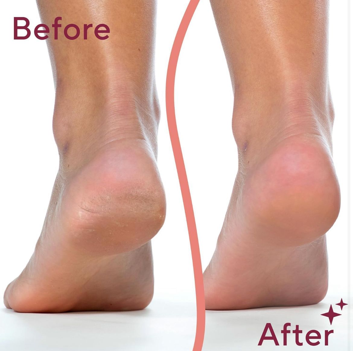 Rechargeable Electronic Pedicure Tool – Dual Speed Callus Remover with 2 Roller Heads & USB Charger (Pink & Rose Gold)